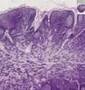 Shotgun Histology Lymph Node