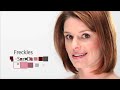 Bioderm Photofacial