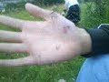 Thorn Clapping Thorn Clapping