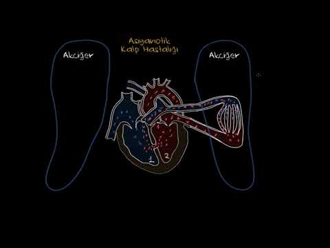 Khan Academy - Eisenmenger Sendromu Nedir? (Fen Bilimleri) (Sağlık ve Tıp) - 2021.01.12