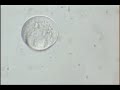 Embryo biopsy Athens