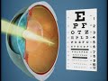 Lentes Faquitos Laser Vision Center Lentes Faquitos Laser Vision Center