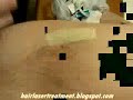 How Laser Hair Work For Your Body How Laser Hair Work For Your Body
