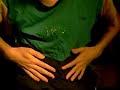 Pectus Excavatum