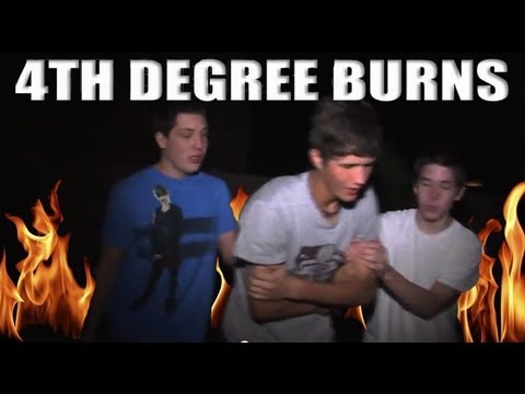 how to treat 4th degree burns