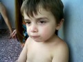 Perra ataca a niño