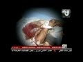 Anonymous - FREE LIBYA, WAKE UP! - To all people of good will View Video