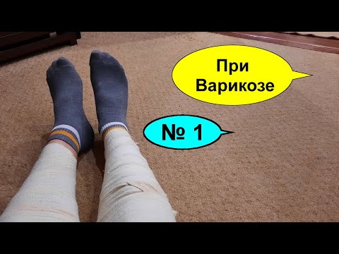 Лечение варикоз вен в домашних условиях Лечение варикоз вен в домашних условиях