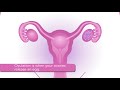 Dr. Siobhan Dolan talks about how ovulation happens and how to get pregnant.