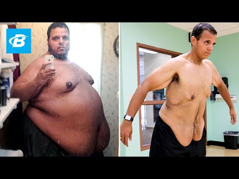 The Incredible Shrinking Man | Jesse Shand Lost 350 Pounds