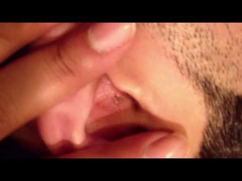 how to relieve popped ears
