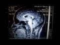 Please click on me to play my video!