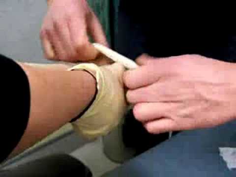 how to locate a dislocated wrist