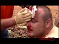 Drunk Guy Breaks Bottle Over His Head