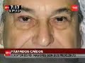 Operación Parpados IOPA