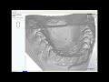 Orthodontic Model Scan - CadBluDental.com