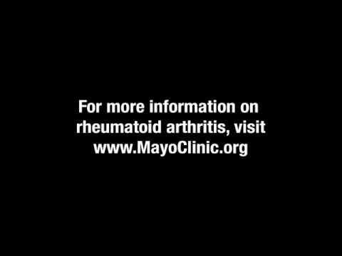 how to treat rheumatoid arthritis