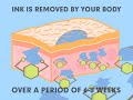Laser Tattoo Removal - All About Laser Tattoo Removal Laser Tattoo Removal - All About Laser Tattoo Removal