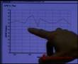 Diabetes: Two Important Kidney Tests
