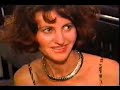 amputee ellen 3