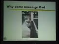 Lecture - HTO in Knee Osteoarthritis - Part 1