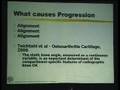 Lecture - HTO in Knee Osteoarthritis - Part 1