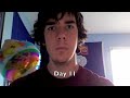 jaw-surgery.html