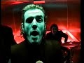 Triggerfinger