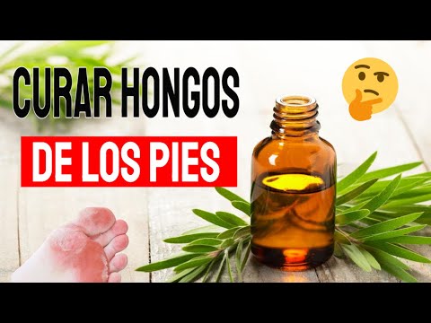 El hongo de las uñas la traducción en alemán
