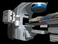 Varian IGRT kV-MV Imaging