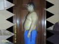 Mudanças 2 anos após a cirurgia Bariátrica(Gastroplastia)