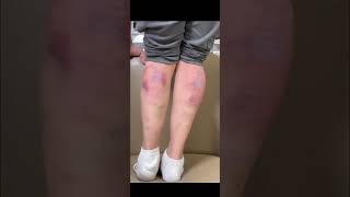 나의 첫 종아리 하드 실플