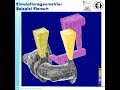 Numerische Simulation des Gieß- und Erstarrungsprozesses Numerische Simulation des Gieß- und Erstarrungsprozesses