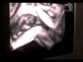 videos de MOV00005