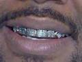 Grillz