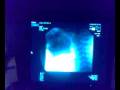 videos de X-Ray Crackers 12-03-08