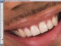 Portrait Makeover Part 1 - Whitening Teeth & Eyes Portrait Makeover Part 1 - Whitening Teeth & Eyes