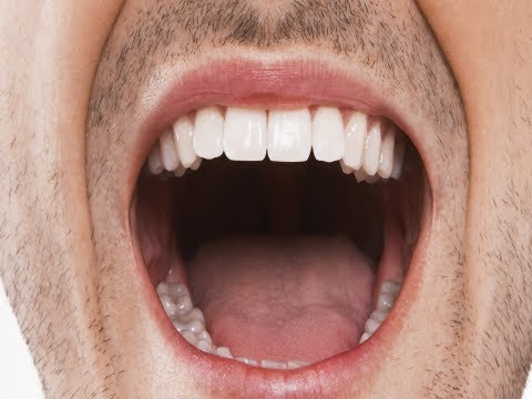 how to cure halitosis