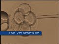 IPGO - D P I - DIAGNOSTICO PRE IMPLANTACIONAL