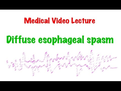 how to relieve esophagus spasm