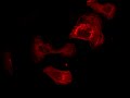U2OS-TagRFP-Actin Human osteosarcoma cells were stably transfected with a plasmid coding for TagRFP-labeled human β-actin. Their bright and well formed actin fibers make these cells a useful tool suitable for all experiments involving the actin-based cytoskeleton and allow the observation of the cytoskeleton within living cells in real time. Due to their fast growth, absence of contact inhibition and easy handling, U2OS cells constitute an ideal tumor model. Acquisition of this live cell movie was performed at the Nikon Imaging Center at the University of Heidelberg.