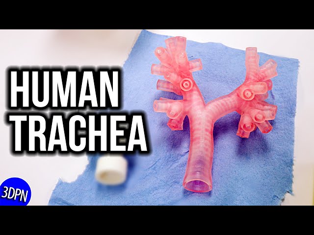 Innovating Pediatric Care: 3D Printing at Seattle Children’s Hospital