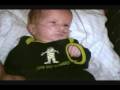 videos de For our Hydrocephalus Baby (world's apart)