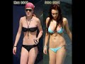 ANOREXIA ANOREXIA