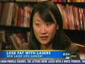 Smart Lipo