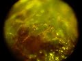 morgellons nano-machines with rotating locomotion morgellons nano-machines with rotating locomotion