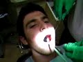 Dani Levine having his wisdom teeth removed Dani Levine having his wisdom teeth removed