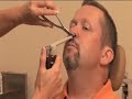 Snoring Center - LIVE Pillar Procedure Snoring Center - LIVE Pillar Procedure