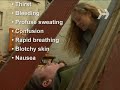 How To Treat Someone For Shock How To Treat Someone For Shock