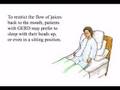 Gastroesophageal Reflux Disease (GERD)